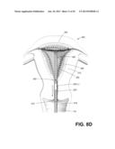 METHODS AND SYSTEMS FOR EVALUATING THE INTEGRITY OF A UTERINE CAVITY diagram and image
