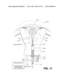 METHODS AND SYSTEMS FOR EVALUATING THE INTEGRITY OF A UTERINE CAVITY diagram and image