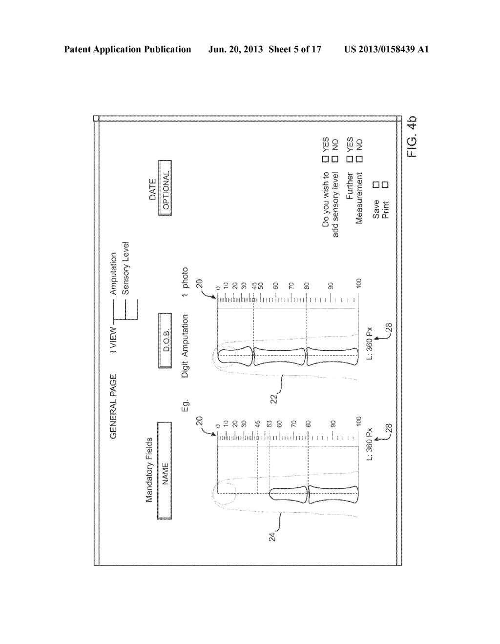 UPPER LIMB IMPAIRMENT MEASUREMENT SYSTEM - diagram, schematic, and image 06