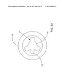 Delivering Ocular Implants Into the Eye diagram and image