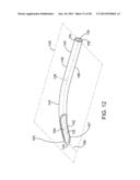 Delivering Ocular Implants Into the Eye diagram and image