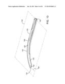 Delivering Ocular Implants Into the Eye diagram and image