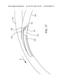 Delivering Ocular Implants Into the Eye diagram and image