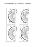 Delivering Ocular Implants Into the Eye diagram and image