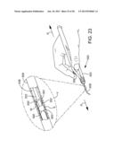 Delivering Ocular Implants Into the Eye diagram and image