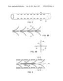 SELF CLEANING SHUNT diagram and image