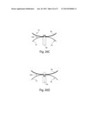 DELIVERING AND/OR RECEIVING MATERIAL WITH RESPECT TO A SUBJECT SURFACE diagram and image