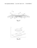 DELIVERING AND/OR RECEIVING MATERIAL WITH RESPECT TO A SUBJECT SURFACE diagram and image