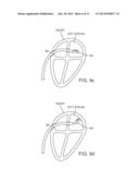 APPARATUS AND METHOD FOR SENSING FORCE ON A ROBOTICALLY CONTROLLED MEDICAL     INSTRUMENT diagram and image