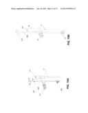 METHOD AND DEVICE OF DETECTING AND/OR BLOCKING REFLUX diagram and image