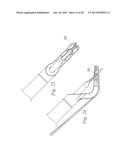 SUTURE PASSER AND METHOD diagram and image