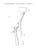 SUTURE PASSER AND METHOD diagram and image