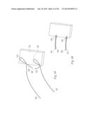 SUTURE PASSER AND METHOD diagram and image