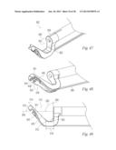 SUTURE PASSER AND METHOD diagram and image