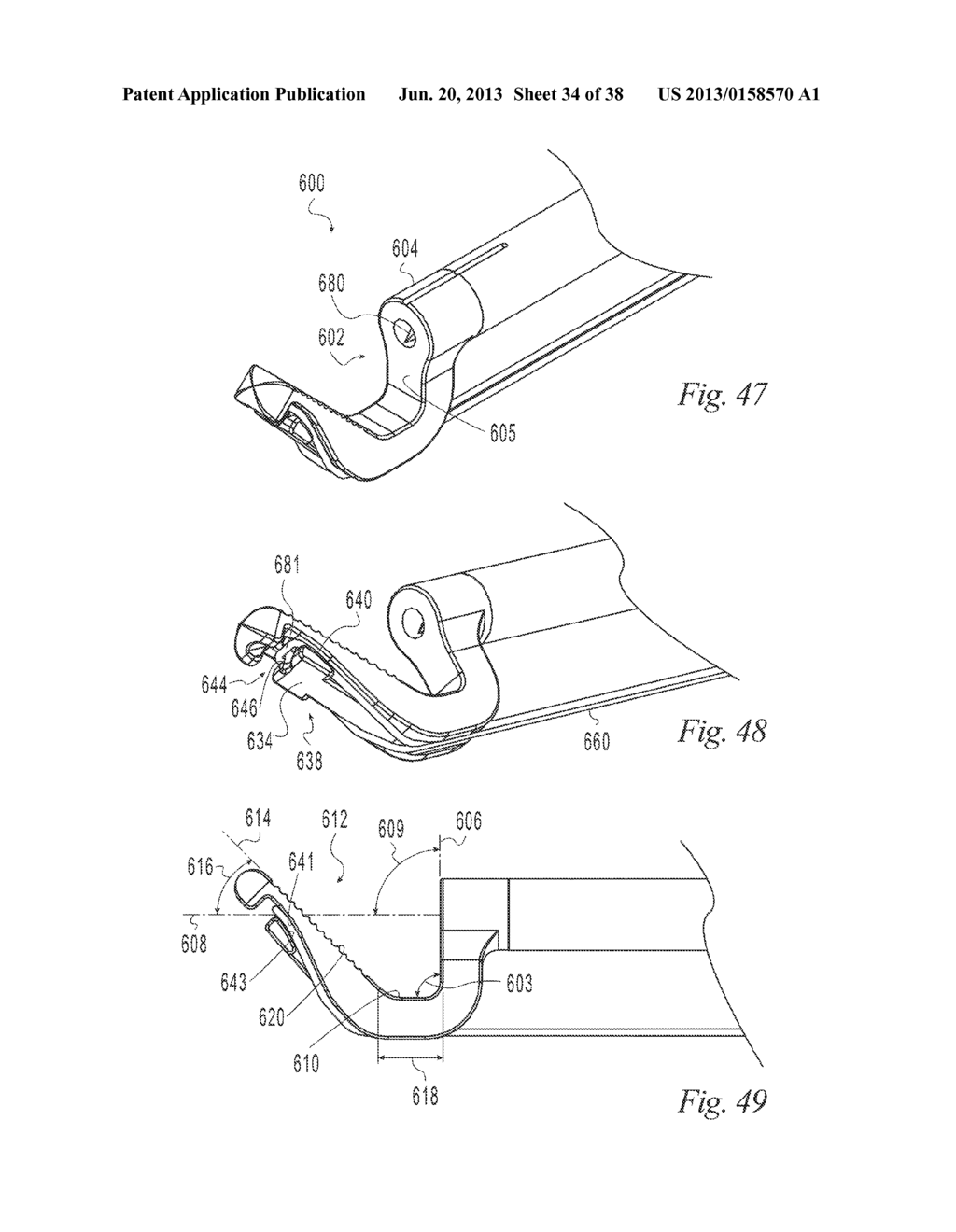 SUTURE PASSER AND METHOD - diagram, schematic, and image 35