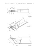 SUTURE PASSER AND METHOD diagram and image