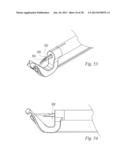 SUTURE PASSER AND METHOD diagram and image