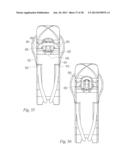 SUTURE PASSER AND METHOD diagram and image