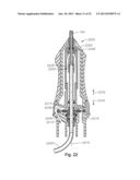 VITRECTOMY PROBE WITH ADJUSTABLE CUTTER PORT SIZE diagram and image