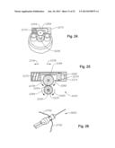 VITRECTOMY PROBE WITH ADJUSTABLE CUTTER PORT SIZE diagram and image