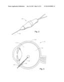 VITRECTOMY PROBE WITH ADJUSTABLE CUTTER PORT SIZE diagram and image