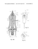 VITRECTOMY PROBE WITH ADJUSTABLE CUTTER PORT SIZE diagram and image