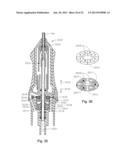 VITRECTOMY PROBE WITH ADJUSTABLE CUTTER PORT SIZE diagram and image