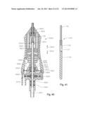 VITRECTOMY PROBE WITH ADJUSTABLE CUTTER PORT SIZE diagram and image