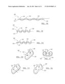 Soft Tissue Repair Assembly And Associated Method diagram and image