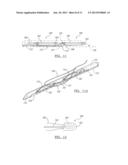 Soft Tissue Repair Assembly And Associated Method diagram and image