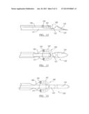 Soft Tissue Repair Assembly And Associated Method diagram and image