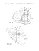 Soft Tissue Repair Assembly And Associated Method diagram and image