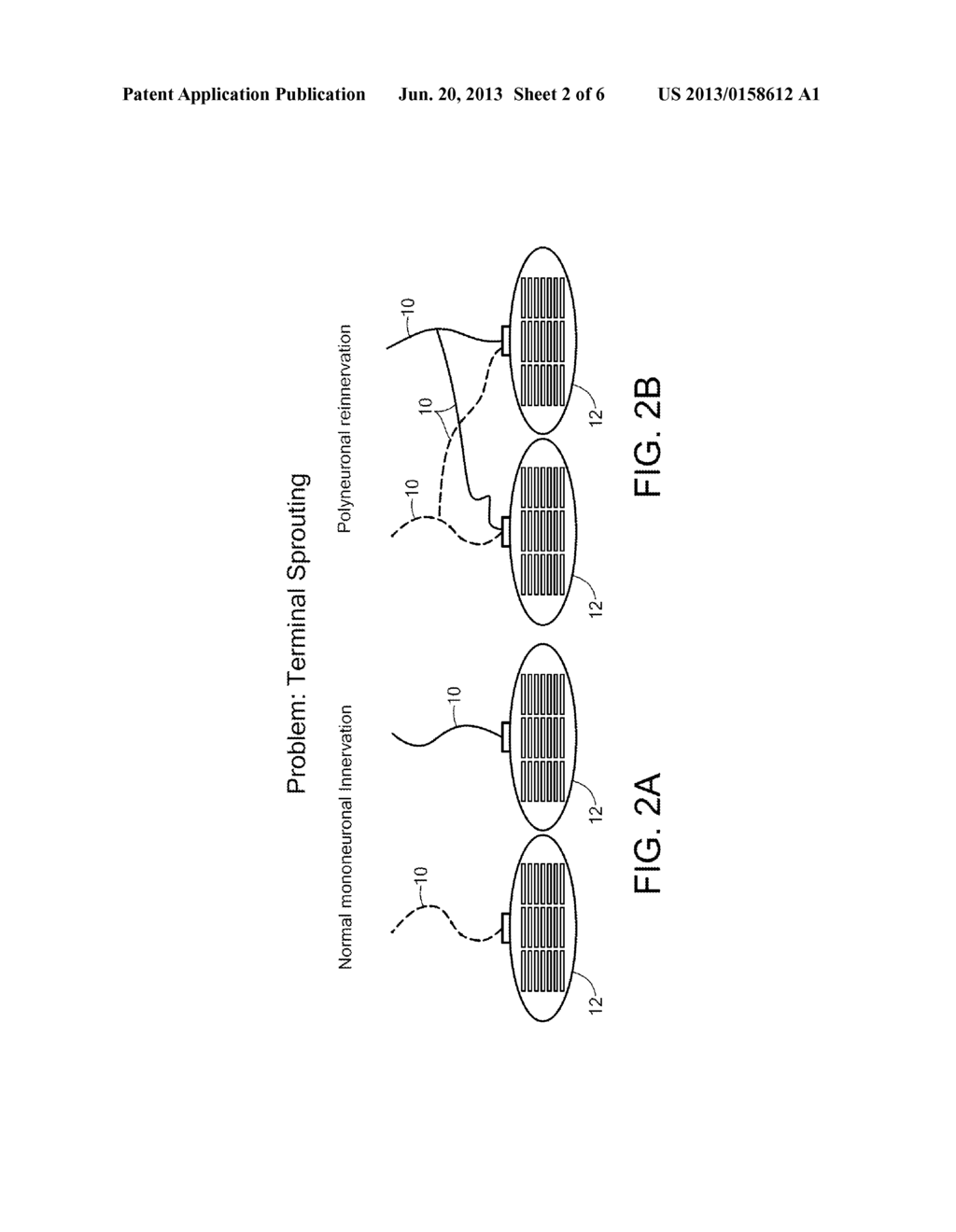 System and Method for Eyelid Simulation - diagram, schematic, and image 03