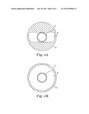 LEAD ANCHORING SYSTEM WITH LIMITED MOVEMENT OF ANCHORING DEVICE ALONG LEAD diagram and image