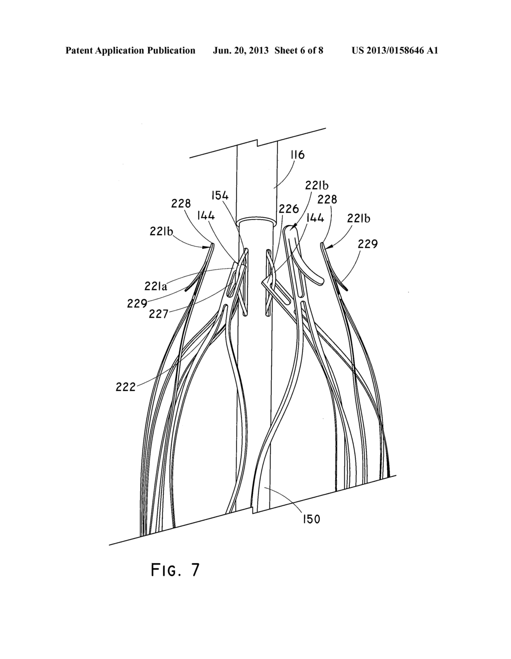 CIRCUMFERENTIAL TRIGGER WIRE FOR DEPLOYING AN ENDOLUMINAL PROSTHESIS - diagram, schematic, and image 07