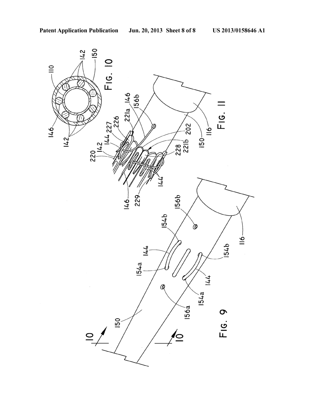 CIRCUMFERENTIAL TRIGGER WIRE FOR DEPLOYING AN ENDOLUMINAL PROSTHESIS - diagram, schematic, and image 09