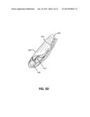 APPOSITION FIBER FOR USE IN ENDOLUMINAL DEPLOYMENT OF EXPANDABLE IMPLANTS diagram and image