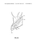 APPOSITION FIBER FOR USE IN ENDOLUMINAL DEPLOYMENT OF EXPANDABLE IMPLANTS diagram and image