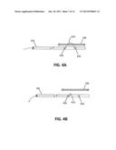 APPOSITION FIBER FOR USE IN ENDOLUMINAL DEPLOYMENT OF EXPANDABLE IMPLANTS diagram and image