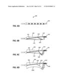 APPOSITION FIBER FOR USE IN ENDOLUMINAL DEPLOYMENT OF EXPANDABLE IMPLANTS diagram and image