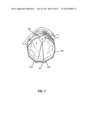 APPOSITION FIBER FOR USE IN ENDOLUMINAL DEPLOYMENT OF EXPANDABLE IMPLANTS diagram and image