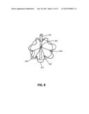 APPOSITION FIBER FOR USE IN ENDOLUMINAL DEPLOYMENT OF EXPANDABLE IMPLANTS diagram and image