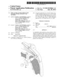 IMPLANTABLE TENDON PROTECTION SYSTEMS AND RELATED KITS AND METHODS diagram and image