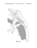 IMPLANTABLE TENDON PROTECTION SYSTEMS AND RELATED KITS AND METHODS diagram and image