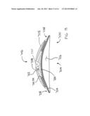 IMPLANTABLE TENDON PROTECTION SYSTEMS AND RELATED KITS AND METHODS diagram and image