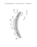 IMPLANTABLE TENDON PROTECTION SYSTEMS AND RELATED KITS AND METHODS diagram and image