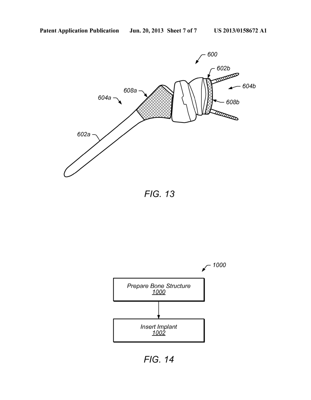 BONE IMPLANT INTERFACE SYSTEM AND METHOD - diagram, schematic, and image 08