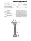 Anti-Leakage Prosthesis diagram and image