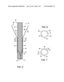 Anti-Leakage Prosthesis diagram and image