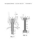 Anti-Leakage Prosthesis diagram and image